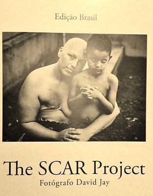 the-scar-project